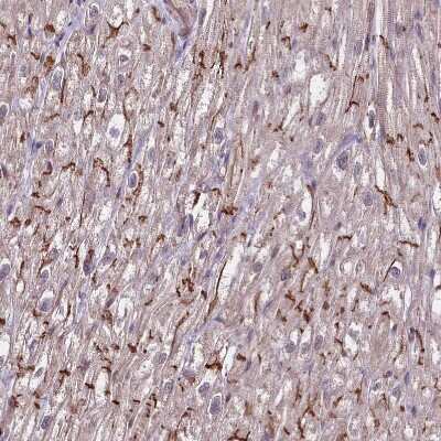 Immunohistochemistry-Paraffin: Tafazzin/TAZ Antibody [NBP1-88511]