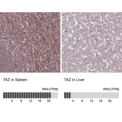 Immunohistochemistry-Paraffin: Tafazzin/TAZ Antibody [NBP1-88511]