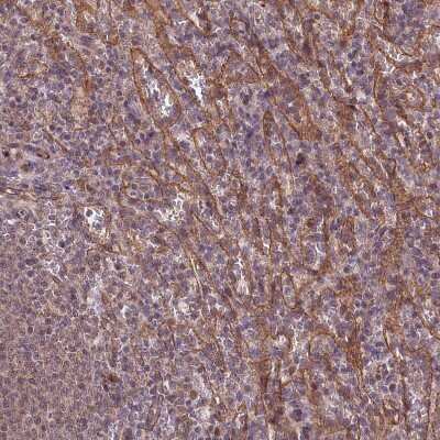 Immunohistochemistry-Paraffin: Tafazzin/TAZ Antibody [NBP1-88511]