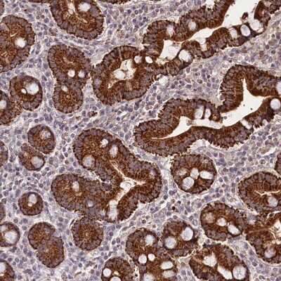 Immunohistochemistry-Paraffin: Tafazzin/TAZ Antibody [NBP1-88511]