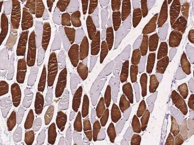 Immunohistochemistry-Paraffin: Tafazzin/TAZ Antibody [NBP2-98750]