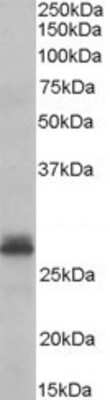 Western Blot: Tafazzin/TAZ Antibody [NB600-811]