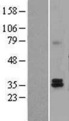 Western Blot: Tafazzin/TAZ Overexpression Lysate [NBL1-16718]