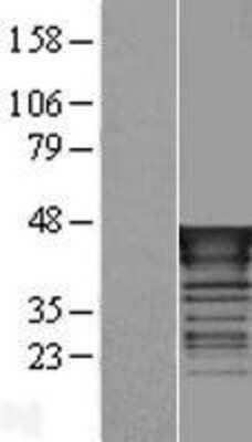 Western Blot: SCL/Tal1 Overexpression Lysate [NBP2-08031]