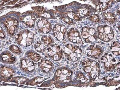Immunohistochemistry-Paraffin: Talin1 Antibody (GT24212) [NBP3-13607]