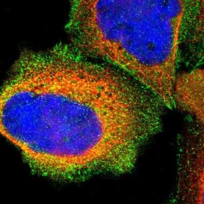 Immunocytochemistry/ Immunofluorescence: Talin1 Antibody [NBP1-87820]