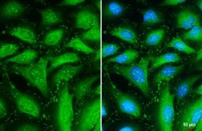 Immunocytochemistry/ Immunofluorescence: Talin1 Antibody [NBP3-13400]