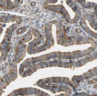 Immunohistochemistry-Paraffin: Talin1 Antibody [NBP1-87820]