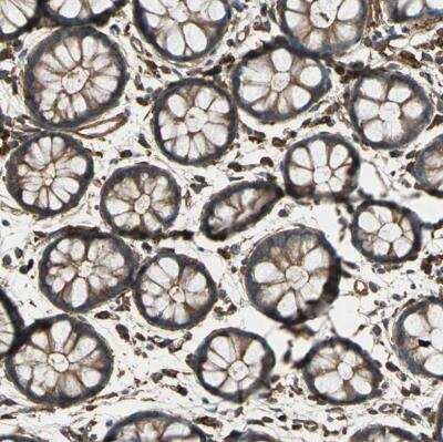 Immunohistochemistry-Paraffin: Talin1 Antibody [NBP1-87820]