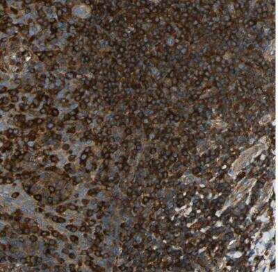 Immunohistochemistry-Paraffin: Talin1 Antibody [NBP1-87820]