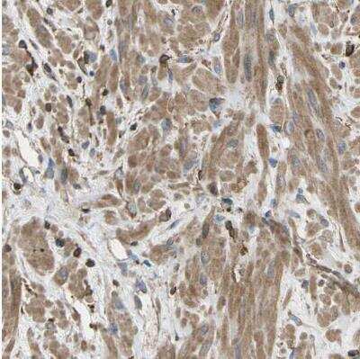 Immunohistochemistry-Paraffin: Talin1 Antibody [NBP1-87820]