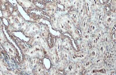 Immunohistochemistry-Paraffin: Talin1 Antibody [NBP3-13400]