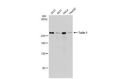 Western Blot: Talin1 Antibody [NBP3-13400]