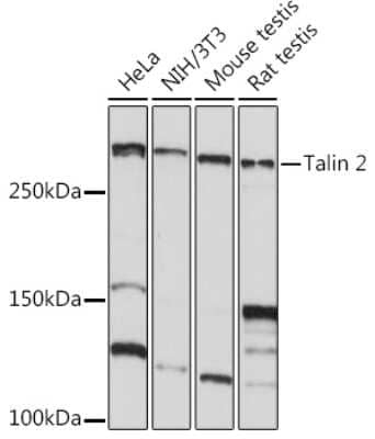 Western Blot: Talin2 Antibody (7D1Y0) [NBP3-15932]