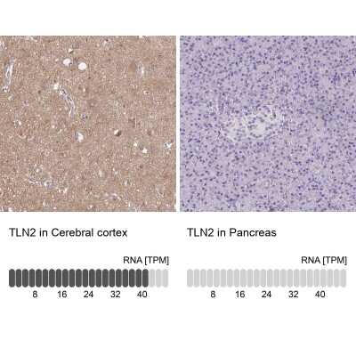 Immunohistochemistry-Paraffin: Talin2 Antibody [NBP2-62621]