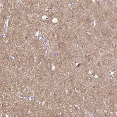 Immunohistochemistry-Paraffin: Talin2 Antibody [NBP2-62621]