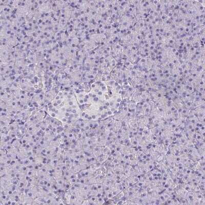 Immunohistochemistry-Paraffin: Talin2 Antibody [NBP2-62621]