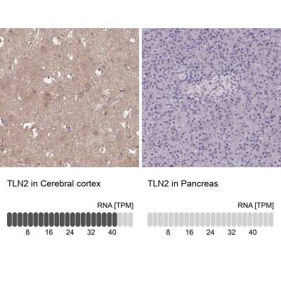 Immunohistochemistry-Paraffin: Talin2 Antibody [NBP2-62623]