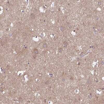 Immunohistochemistry-Paraffin: Talin2 Antibody [NBP2-62623]