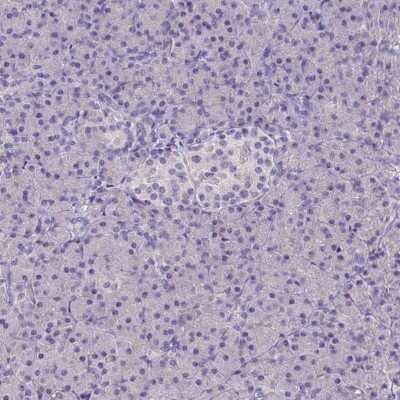 Immunohistochemistry-Paraffin: Talin2 Antibody [NBP2-62623]