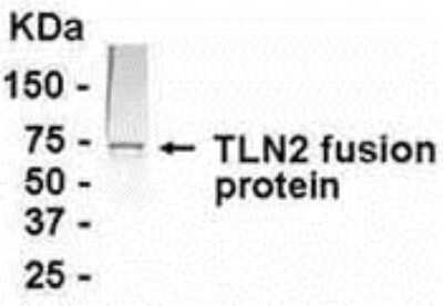 Western Blot: Talin2 AntibodyAzide and BSA Free [NB300-356]