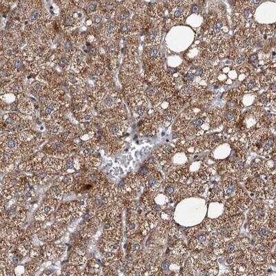 Immunohistochemistry-Paraffin: Tankyrase 1 Antibody [NBP1-80947]