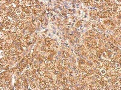 Immunohistochemistry-Paraffin: Tankyrase 1 Antibody [NBP2-20559]