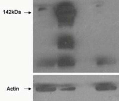 Western Blot: Tankyrase 1 Antibody [NBP1-36994]