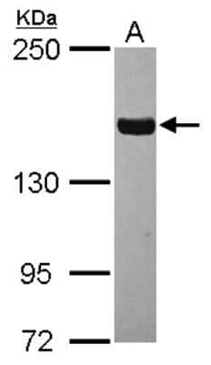 Western Blot: Tankyrase 1 Antibody [NBP2-20559]