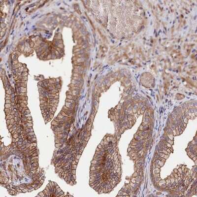Immunohistochemistry: Tankyrase binding protein 1 Antibody [NBP2-34041]