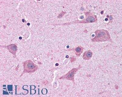 Immunohistochemistry-Paraffin: Tankyrase binding protein 1 Antibody [NB300-988]