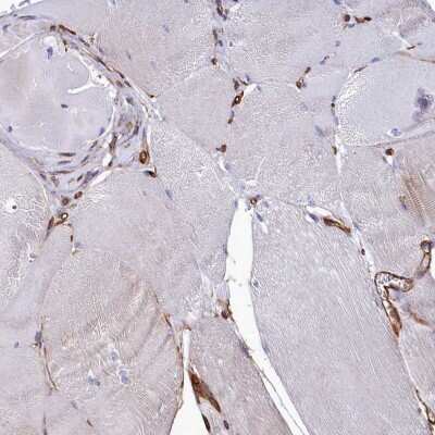 Immunohistochemistry-Paraffin: Tankyrase binding protein 1 Antibody [NBP1-89826]