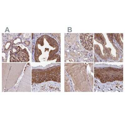 Immunohistochemistry-Paraffin: Tankyrase binding protein 1 Antibody [NBP1-89826]