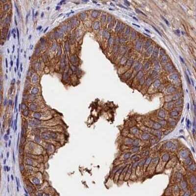 Immunohistochemistry-Paraffin: Tankyrase binding protein 1 Antibody [NBP1-89826]