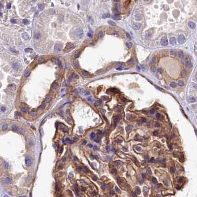 Immunohistochemistry-Paraffin: Tankyrase binding protein 1 Antibody [NBP1-89826]