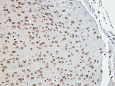Immunohistochemistry-Paraffin: Tankyrase binding protein 1 Antibody [NBP2-20561]