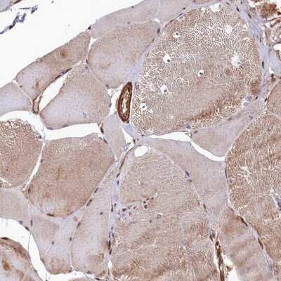 Immunohistochemistry-Paraffin: Tankyrase binding protein 1 Antibody [NBP2-34041]