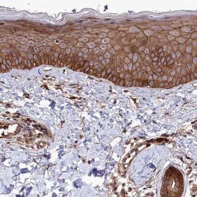 Immunohistochemistry-Paraffin: Tankyrase binding protein 1 Antibody [NBP2-34041]