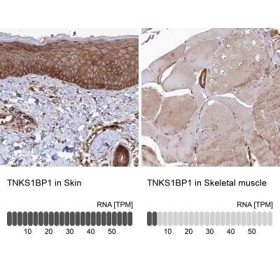 Immunohistochemistry-Paraffin: Tankyrase binding protein 1 Antibody [NBP2-34041]