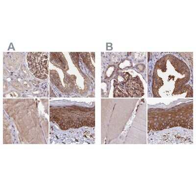 Immunohistochemistry-Paraffin: Tankyrase binding protein 1 Antibody [NBP2-34041]