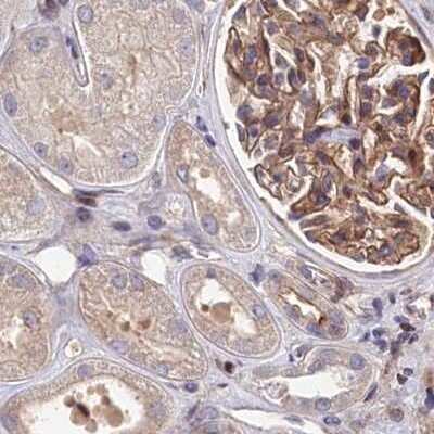 Immunohistochemistry-Paraffin: Tankyrase binding protein 1 Antibody [NBP2-34041]