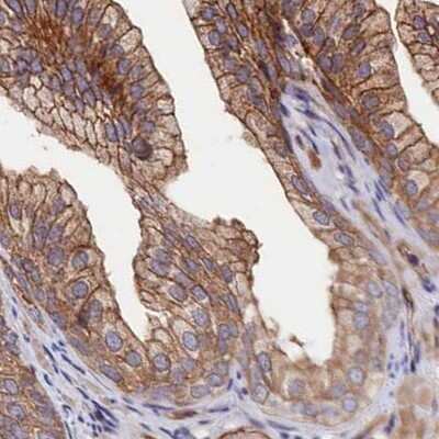 Immunohistochemistry-Paraffin: Tankyrase binding protein 1 Antibody [NBP2-34041]