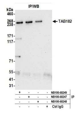 Immunoprecipitation: Tankyrase binding protein 1 Antibody [NB100-68249]