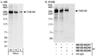 Western Blot: Tankyrase binding protein 1 Antibody [NB100-68247]