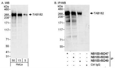 Western Blot: Tankyrase binding protein 1 Antibody [NB100-68248]