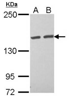 Western Blot: Tankyrase binding protein 1 Antibody [NBP2-20561]