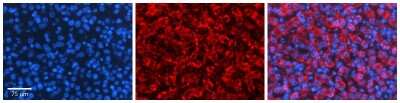 Immunohistochemistry: Tapasin Antibody [NBP1-59070]