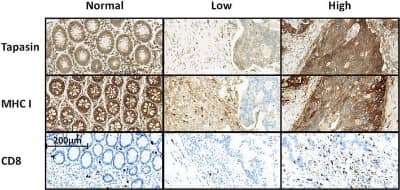 Immunohistochemistry: Tapasin Antibody [NBP1-86968]