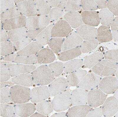 Immunohistochemistry-Paraffin: Tapasin Antibody [NBP1-86968]