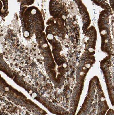 Immunohistochemistry-Paraffin: Tapasin Antibody [NBP1-86968]